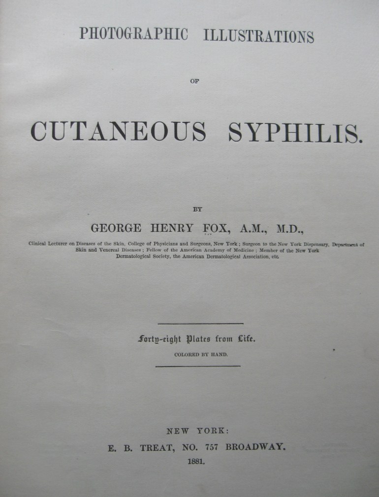 syphilis